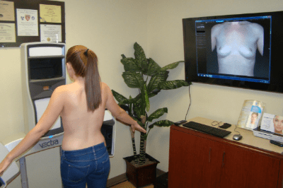VECTRA 3D Breast Enhancement Simulator