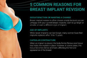 5 COMMON REASONS FOR BREAST IMPLANT REVISION